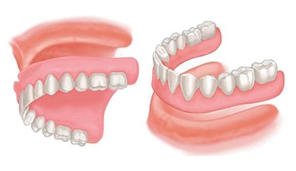 Teeth Dentures Waimea HI 96796